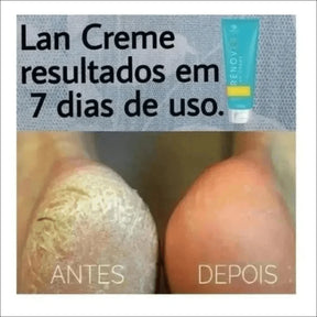 Loção Hidratante para Mãos Rénover Lan Crème 150g - Hidratação Intensiva para Mãos Ressecadas - Jm Grife
