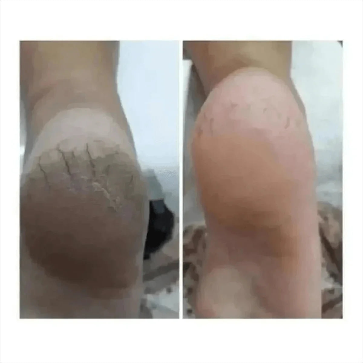 Loção Hidratante para Mãos Rénover Lan Crème 150g - Hidratação Intensiva para Mãos Ressecadas - Jm Grife